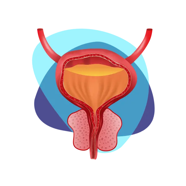 Imagen principal Hiperplasia Prostática Benigna
