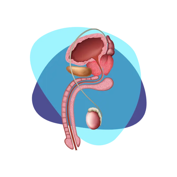 Imagen principal Disfunción Eréctil