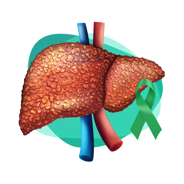 Imagen principal Cáncer de Hígado