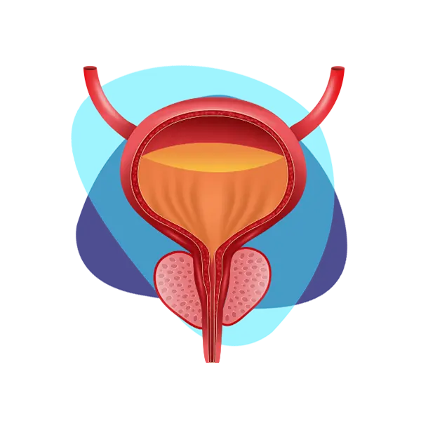 Imagen principal Incontinencia Urinaria Masculina
